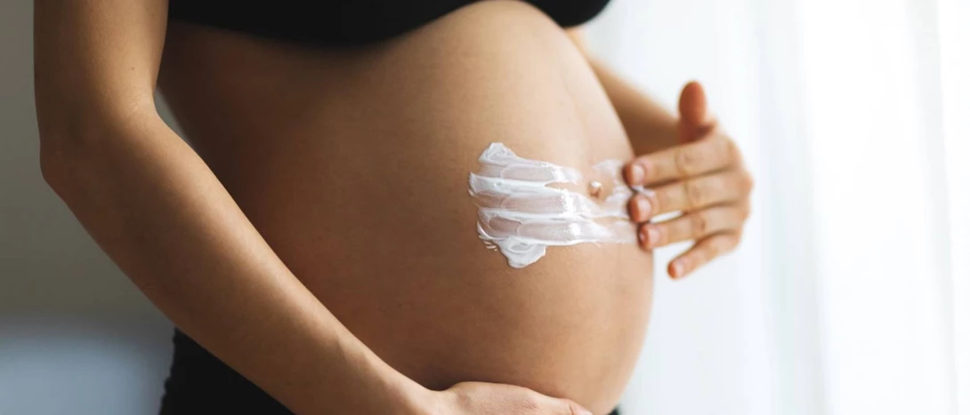 O que fazer para prevenir estrias na gravidez